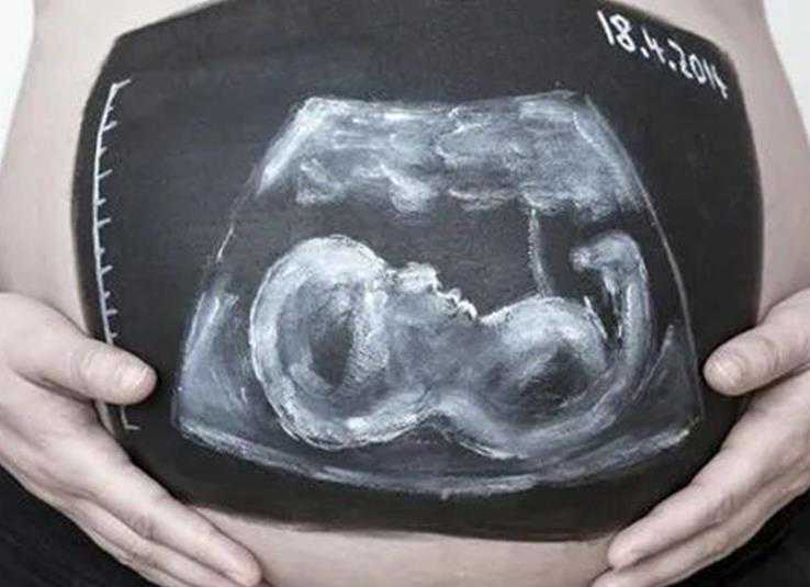 厦门助孕捐卵机构 2022年厦门174试管流程及费用详情一览 ‘四维彩超通过胎心率